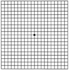 An Amsler grid, as seen  by a person with normal vision.
